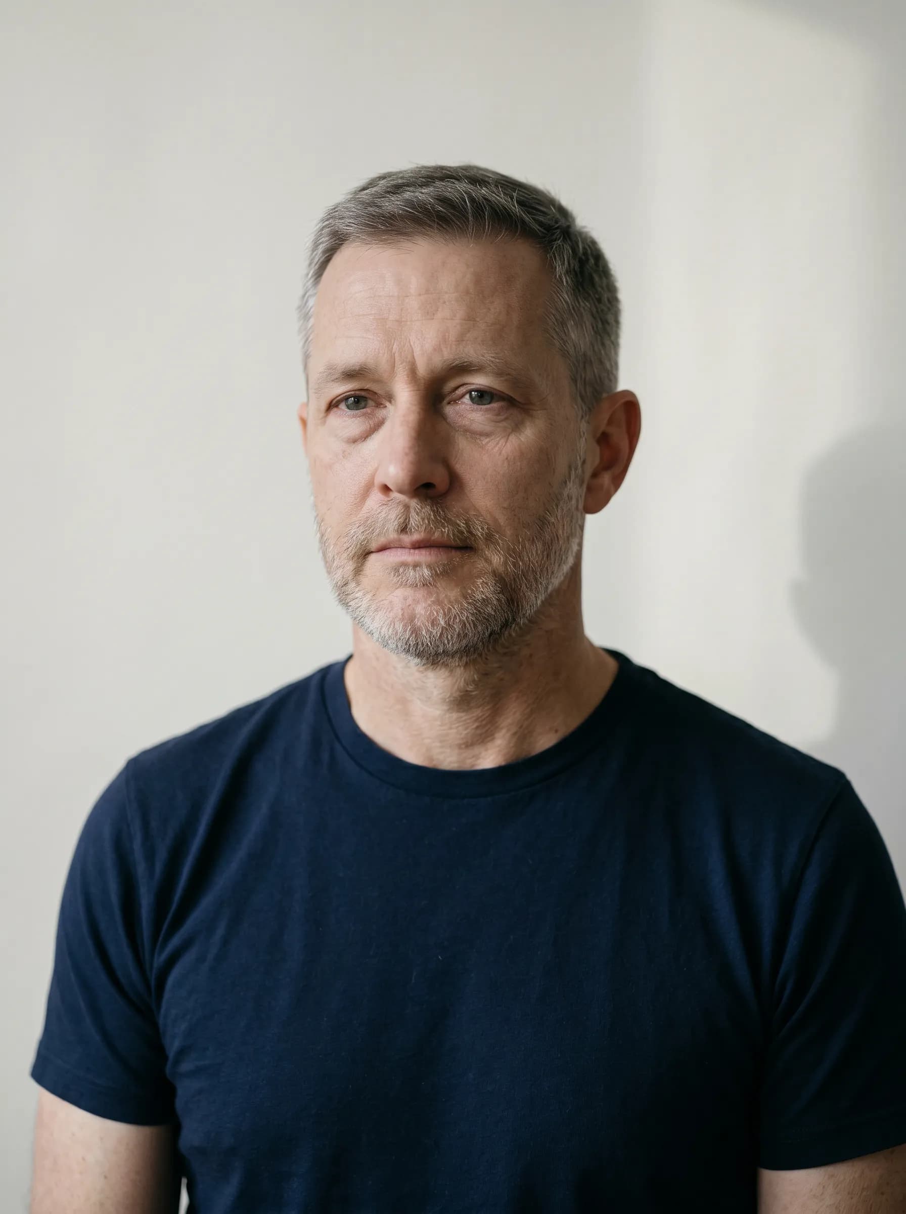 Editorial reconstruction of Theo at baseline with mild under-eye puffiness and dull complexion